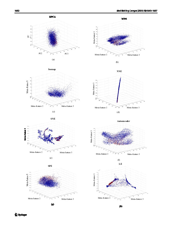 Download Detection of microsleep states from the EEG: A comparison of feature reduction methods.